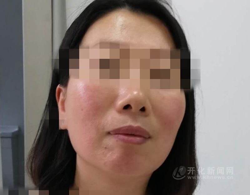 春暖花开 踏青出游小心过敏